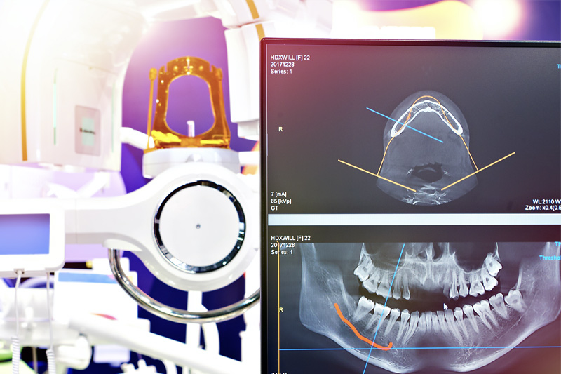 Digital X-Rays in Fishers
