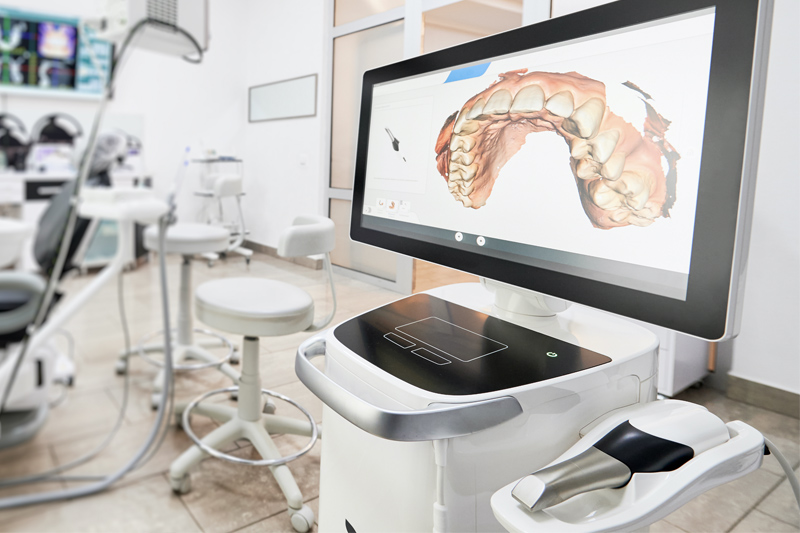 Intra-Oral Scanner in Fishers